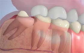 Smile Dental General Dentistry